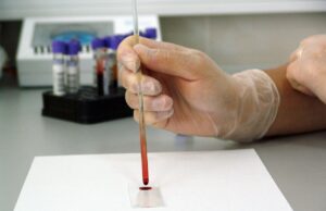 Mund auf – und Leben retten Stadtwerke Rüsselsheim bieten Registrierungsaktion gegen Blutkrebs